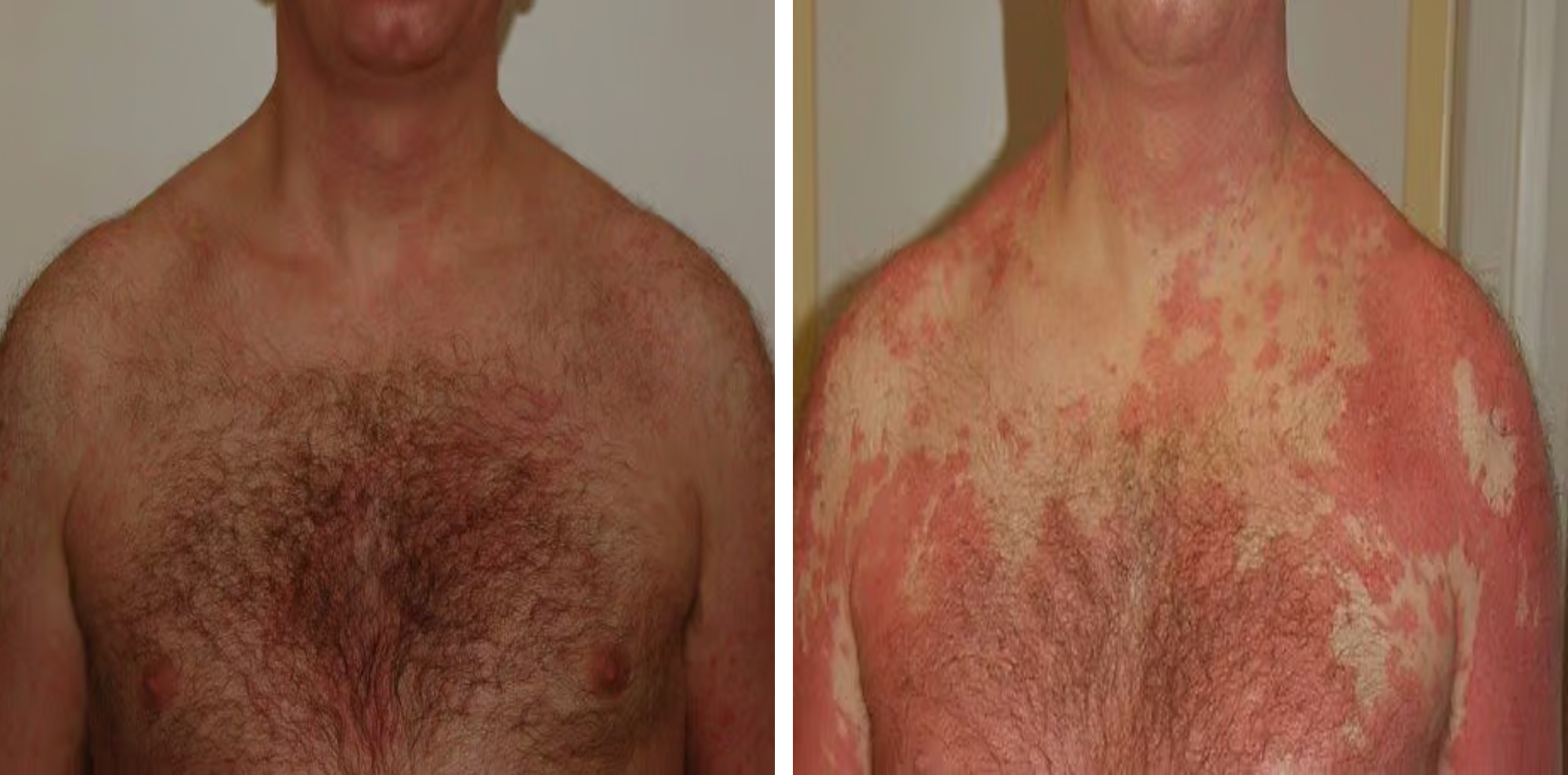 תוצאות טיפול