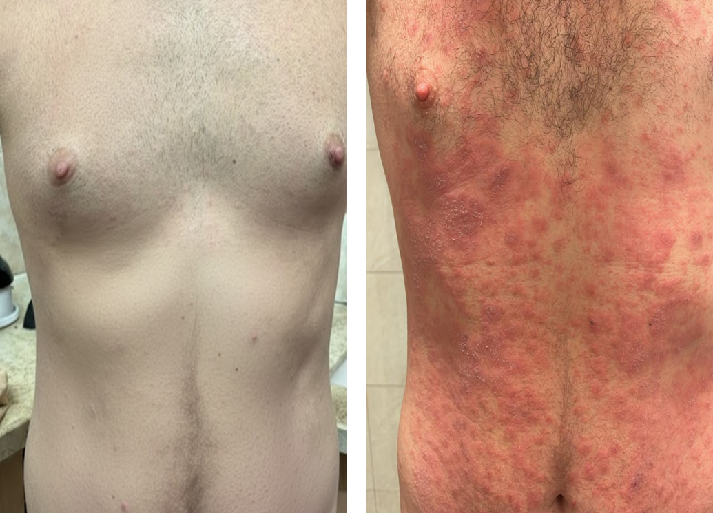 תוצאות טיפול