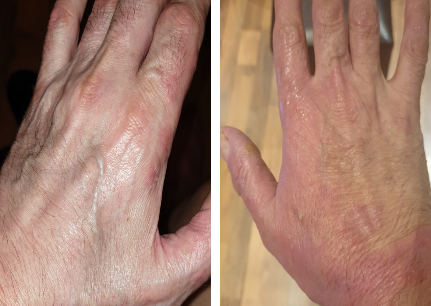 תוצאות טיפול